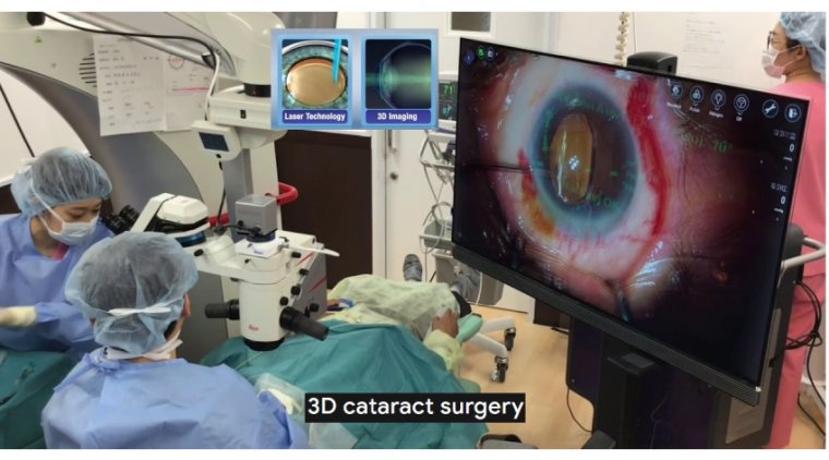 3D Visualization in Cataract Surgery