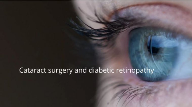 Association of Cataract Surgery With Risk of Diabetic Retinopathy