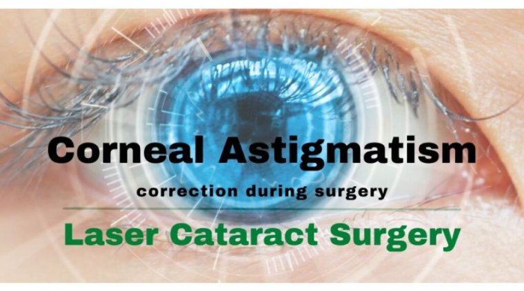 Astigmatism Correction at the Time of Cataract Surgery