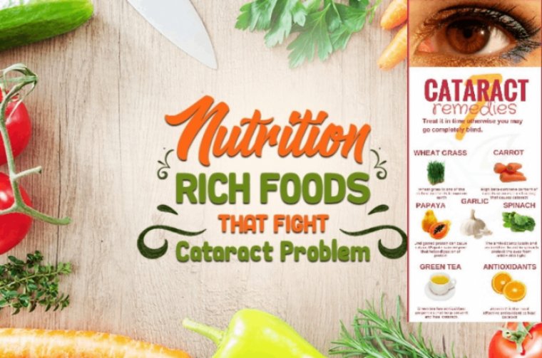 Cataract Patients – Ocular Surface & Good Nutrition
