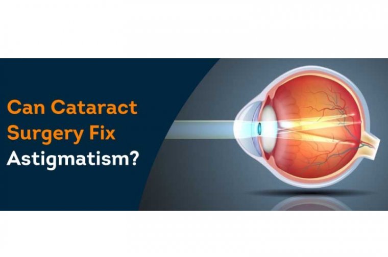 Cataract Surgery & Astigmatism