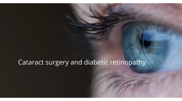Cataract Surgery & Diabetic Retinopathy