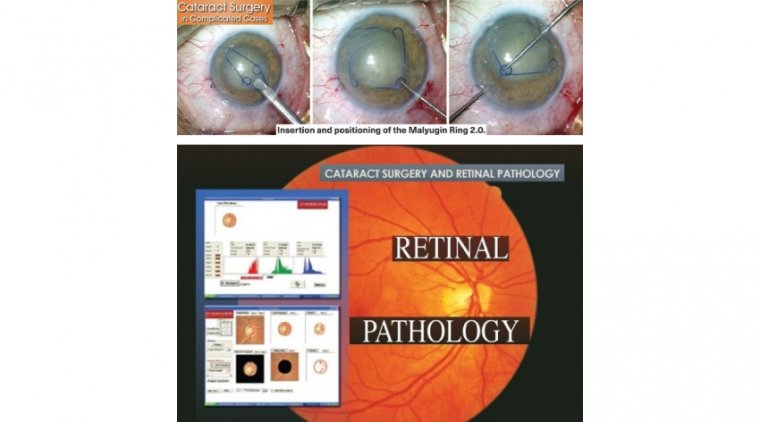 Cataract Surgery in Complex Anterior Segment Pathology 