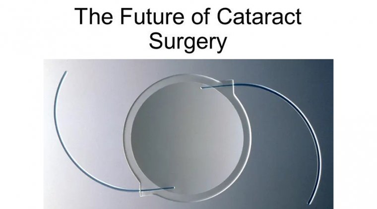 Cataract Surgery & Its Future