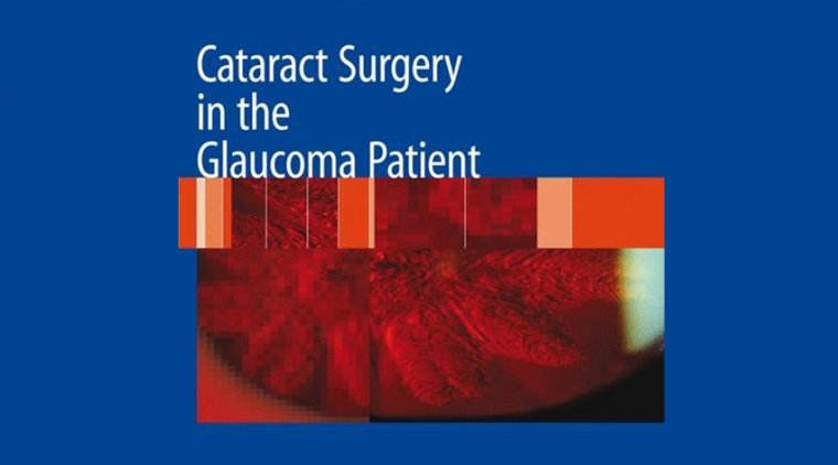 Cataract Surgery – Glaucoma & Combining Laser With MIGS