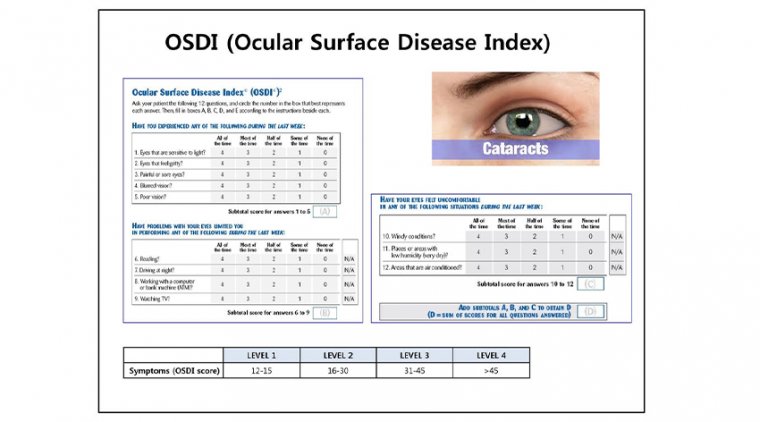 Cataracts & Ocular Surface Disease Index (OSDI)  
