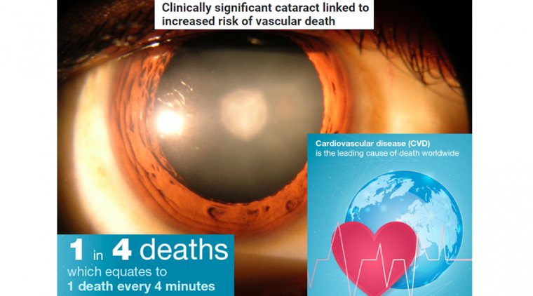 Clinically significant cataract linked to increased risk of vascular death