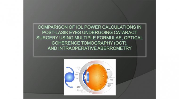Correct IOL Implantation in Cataract Surgery & Intraoperative Aberrometry 