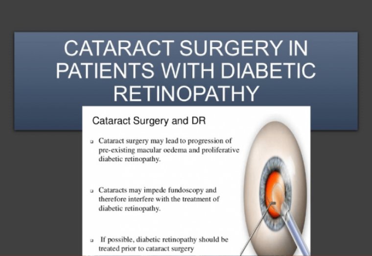 Diabetic Retinopathy & Cataract Surgery