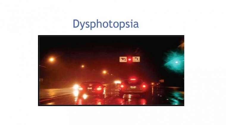Dysphotopsia Visual Symptoms 