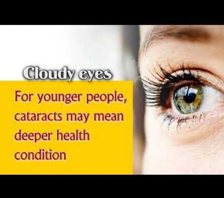 Not Only In Older Populations – Younger People Get Cataracts Too