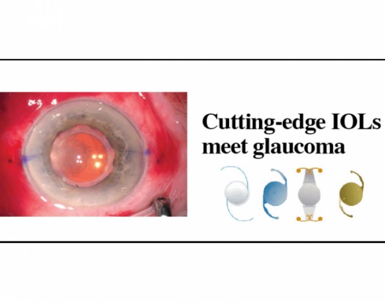 Premium IOLs & Glaucoma Patients