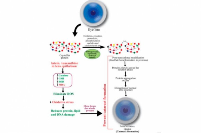 The Biochemistry & Biophysics of Cataract Formation