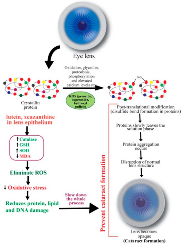 The Effect of Protein Imbalance & Cataracts