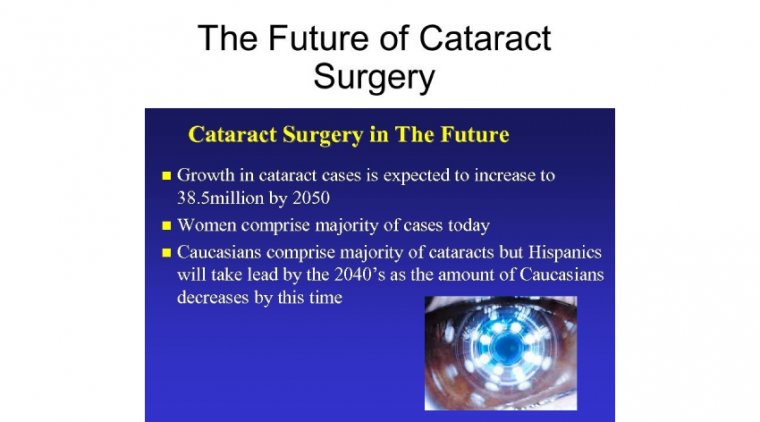 The Future of Cataract Surgery