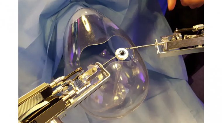 The Future of Robotic Cataract Surgery